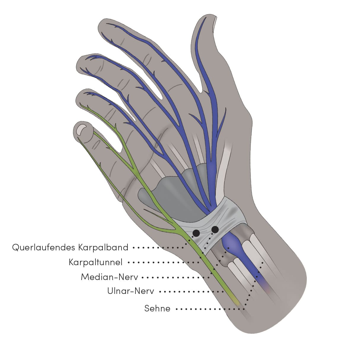 Hand